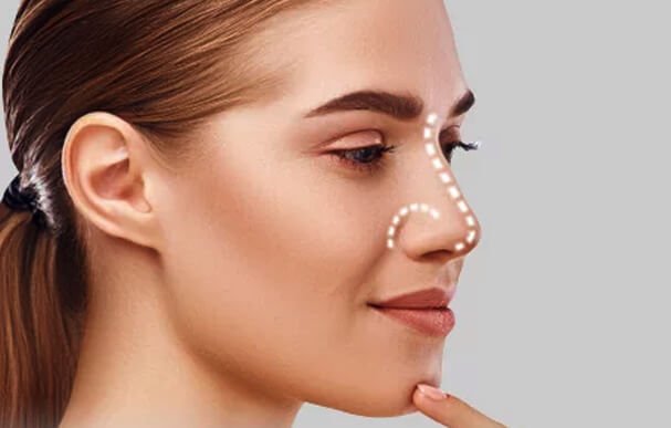 Rhinoplasty Related | Best Cosmetic and Plastic Surgery Clinic in Bangalore | Dr. Harini | Aesthetic International
