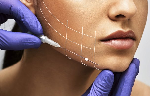 Thread Lift Treatment | Best Cosmetic and Plastic Surgery Clinic in Bangalore | Dr. Harini | Aesthetic International